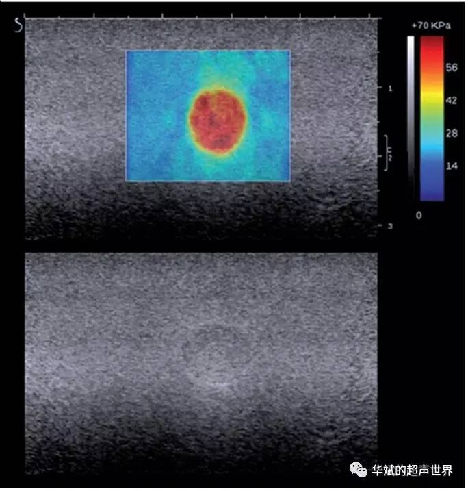 剪切波弹性成像普及系列之五:二维及三维剪切波弹性成像的实现
